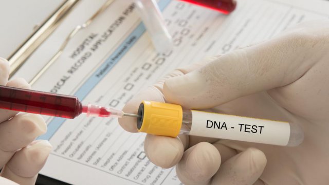 test dna