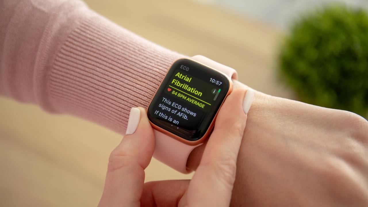 Apple watch ecg Apple watch ecg