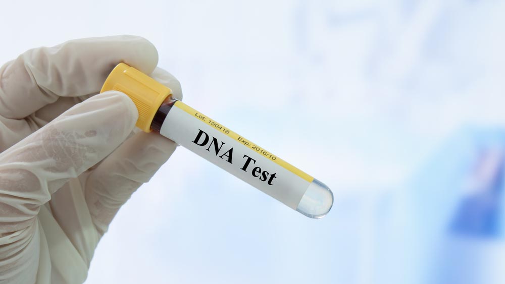 test dna