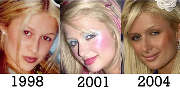 La trasformazione del viso di Paris Hilton nel corso degli anni