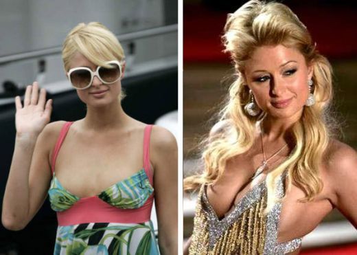 Il nuovo seno di Paris Hilton