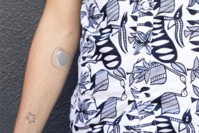 Sano, il wearable per diabetici