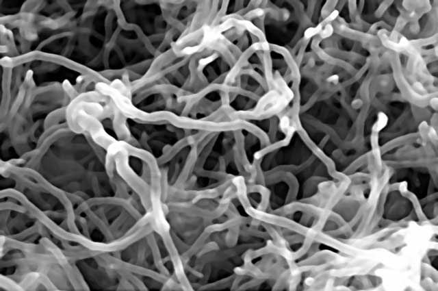Immagine al microscopio dei nanotubi di carbonio
