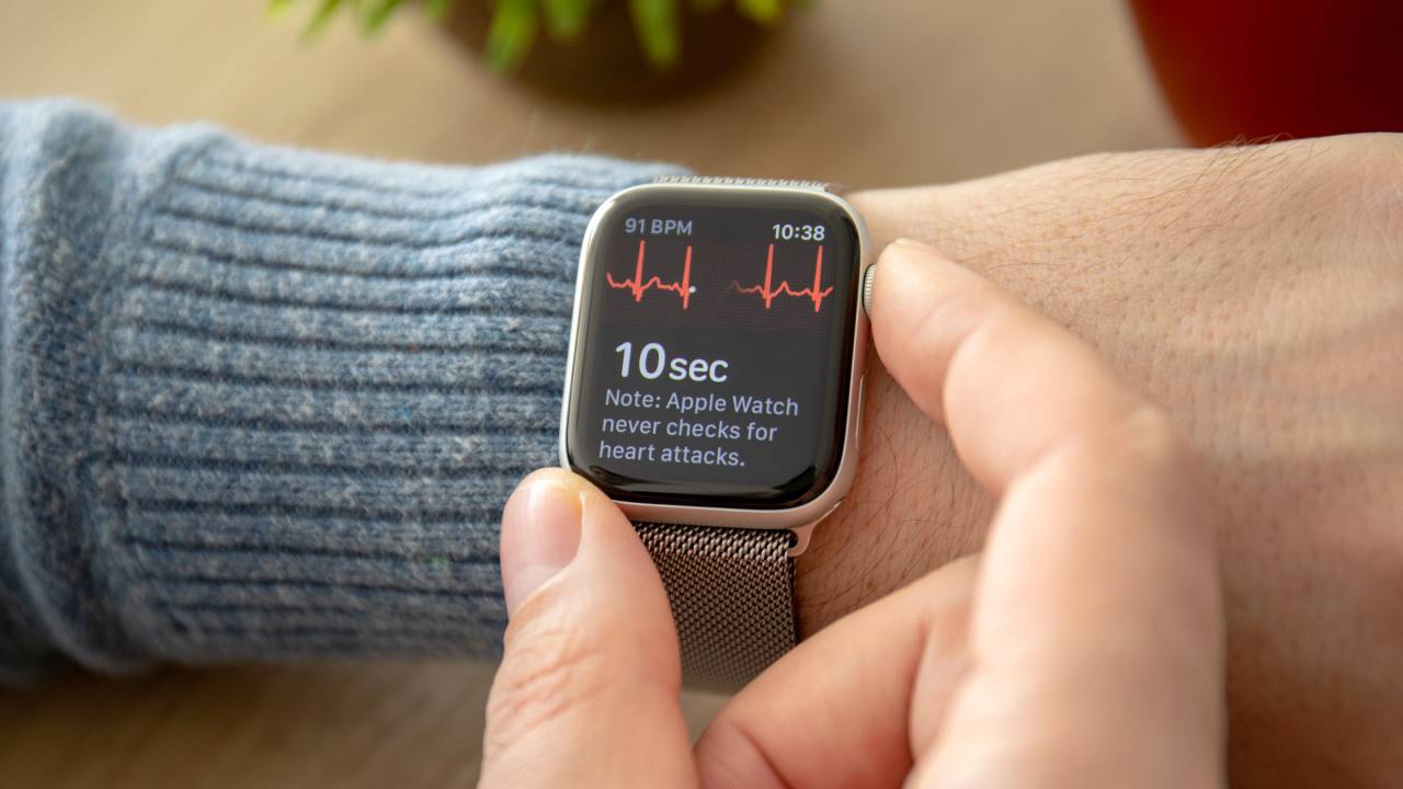 apple watch ecg