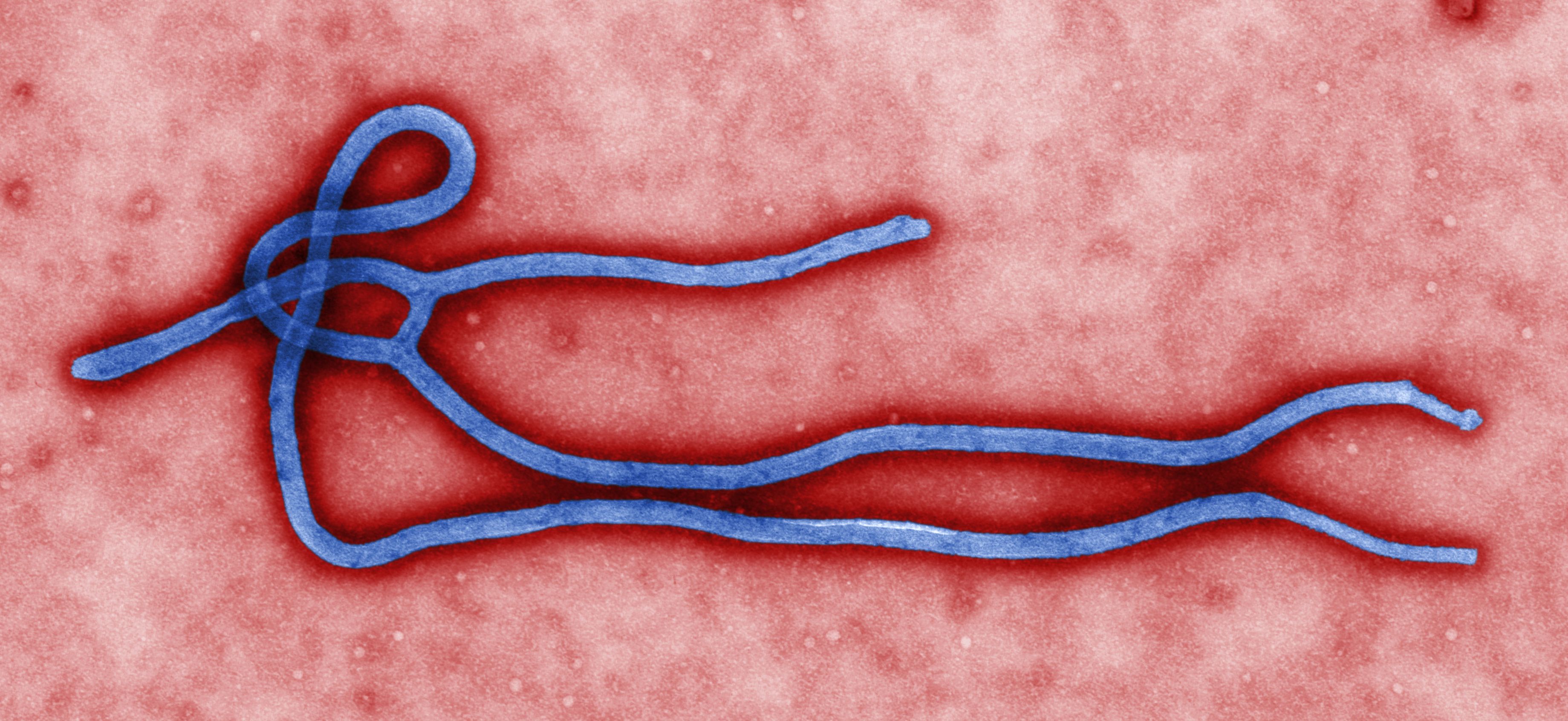 Un'immagine al microscopio elettronico del virus Ebola
